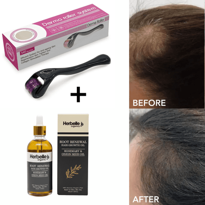 Derma Roller 0.5 mm - Herbelle OraganicsHerbelle Oraganics